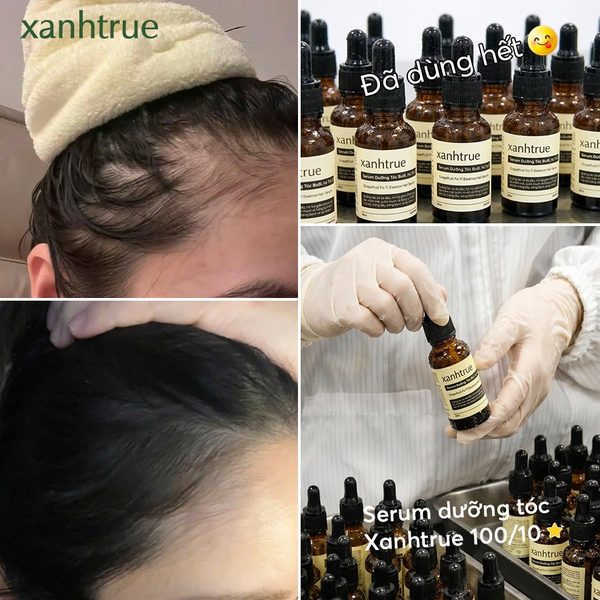 Tiến trình 4 tháng dùng serum xanhtrue